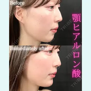 THE FIRST CLINIC 町田院 木暮 啓一郎医師の症例