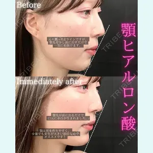 THE FIRST CLINIC 町田院 木暮 啓一郎医師の症例