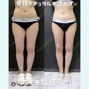 plume clinic 向山 綾子医師の症例