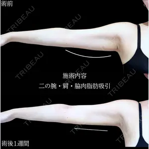 アリエル美容クリニック 横浜院 加藤 敏次医師の症例