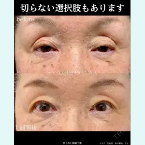 Zetith Beauty Clinic 銀座院 小川 悟史医師の症例