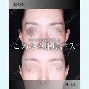 小倉美容外科/美容皮膚科 ビラビューティークリニック 大村 亞蘭医師の症例