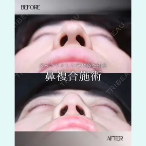 小倉美容外科/美容皮膚科 ビラビューティークリニック 大村 亞蘭医師の症例