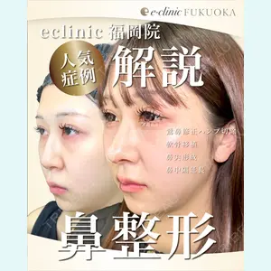 eクリニック 福岡院 伊藤 渉医師の症例