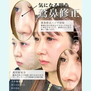 eクリニック 福岡院 伊藤 渉医師の症例