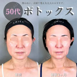 アリエル美容クリニック 水戸院 天白 典秀医師の症例