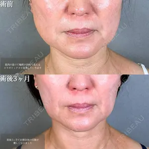 アリエル美容クリニック 水戸院 天白 典秀医師の症例