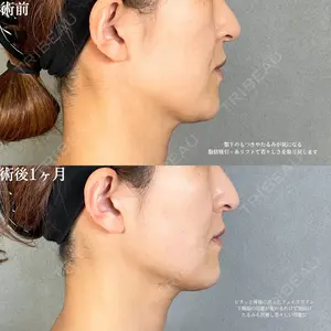 アリエル美容クリニック 大宮院 鈴木　桂介医師の症例