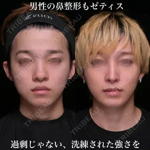 Zetith Beauty Clinic 銀座院 鉄 鑠医師の症例