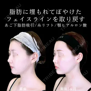 アリエル美容クリニック 郡山院 安齋 誠基医師の症例