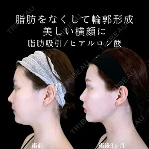 アリエル美容クリニック 郡山院 安齋 誠基医師の症例