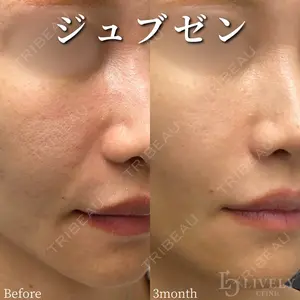 ライブリークリニック 大阪院の症例