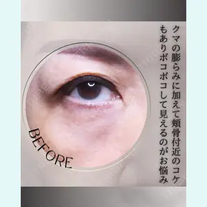 小倉美容外科/美容皮膚科 ビラビューティークリニック 大村 亞蘭医師の症例