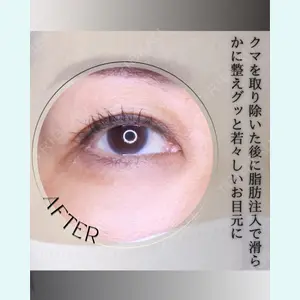 小倉美容外科/美容皮膚科 ビラビューティークリニック 大村 亞蘭医師の症例