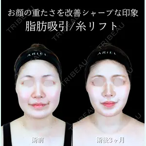 アリエル美容クリニック 横浜院 渡邉 光医師の症例