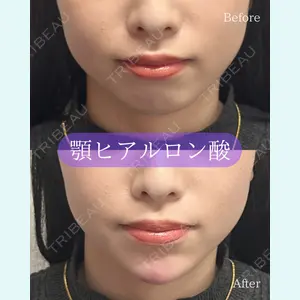 ルラ美容クリニック 郡山院 横瀬 晃平医師の症例