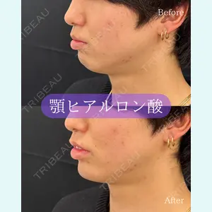 ルラ美容クリニック 郡山院 横瀬 晃平医師の症例