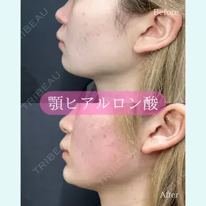 ルラ美容クリニック 郡山院 横瀬 晃平医師の症例