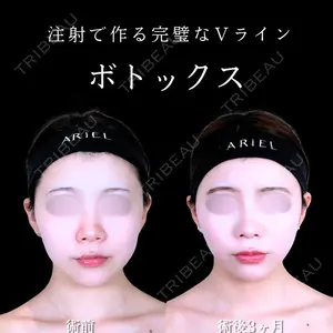 アリエル美容クリニック 水戸院 天白 典秀医師の症例