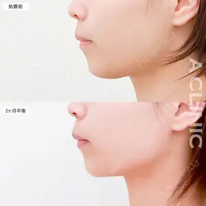 A CLINIC（エークリニック） 大阪院 田窪 賢志郎医師の症例