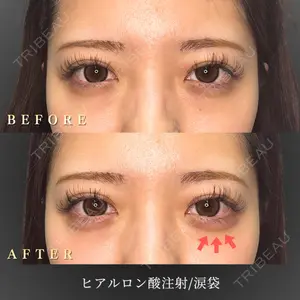 BiBiクリニック 山本 幸一郎医師の症例