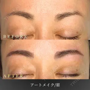 BiBiクリニックの症例