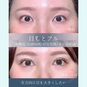 eクリニック 横浜みなとみらい院 坂本 優衣医師の症例