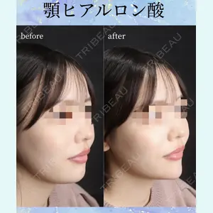 千葉美容外科アイビークリニック 藤田 愛樹医師の症例