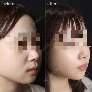 千葉美容外科アイビークリニック 藤田 愛樹医師の症例