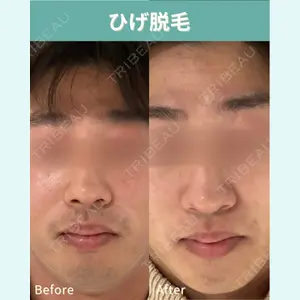 ヴァンヴェールクリニック 高槻院 李 愚姫医師の症例