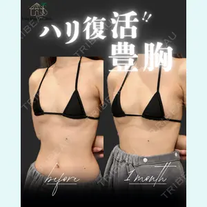 小倉美容外科/美容皮膚科 ビラビューティークリニック 大村 亞蘭医師の症例