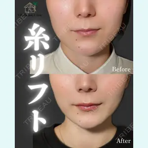 小倉美容外科/美容皮膚科 ビラビューティークリニック 大村 亞蘭医師の症例