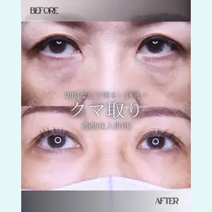 小倉美容外科/美容皮膚科 ビラビューティークリニック 大村 亞蘭医師の症例