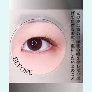 小倉美容外科/美容皮膚科 ビラビューティークリニック 大村 亞蘭医師の症例