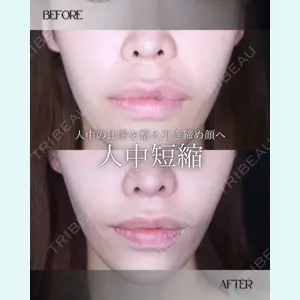 小倉美容外科/美容皮膚科 ビラビューティークリニック 大村 亞蘭医師の症例