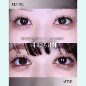 小倉美容外科/美容皮膚科 ビラビューティークリニック 大村 亞蘭医師の症例