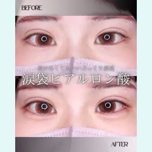 小倉美容外科/美容皮膚科 ビラビューティークリニック 大村 亞蘭医師の症例