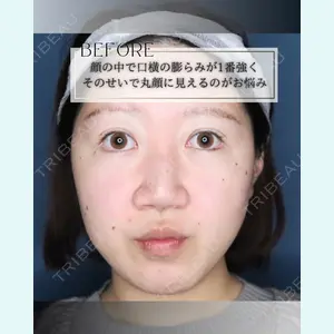 小倉美容外科/美容皮膚科 ビラビューティークリニック 大村 亞蘭医師の症例