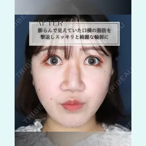 小倉美容外科/美容皮膚科 ビラビューティークリニック 大村 亞蘭医師の症例