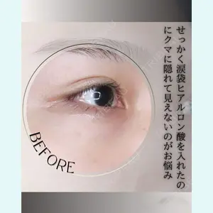 小倉美容外科/美容皮膚科 ビラビューティークリニック 大村 亞蘭医師の症例