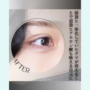 小倉美容外科/美容皮膚科 ビラビューティークリニック 大村 亞蘭医師の症例