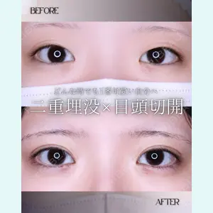 小倉美容外科/美容皮膚科 ビラビューティークリニック 大村 亞蘭医師の症例