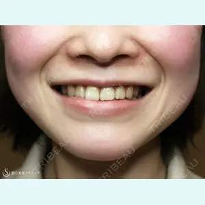 聖心美容クリニック 札幌院 前多 一彦医師の症例