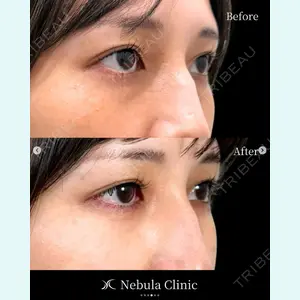 愛知春日井美容外科ネビュラクリニック 都築 諒医師の症例