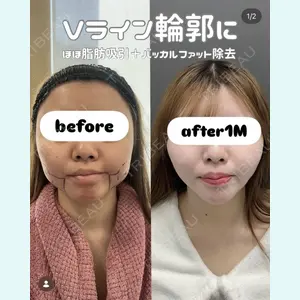 plume clinic 向山 綾子医師の症例