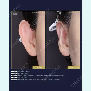 聖心美容クリニック 広島院 中辻 隆徳医師の症例