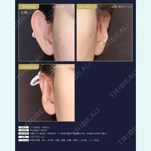 聖心美容クリニック 広島院 中辻 隆徳医師の症例