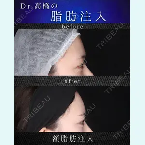 吉祥寺アイビークリニック 高橋 京佑 医師の症例