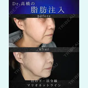 吉祥寺アイビークリニック 高橋 京佑 医師の症例