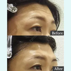 東京形成美容外科 池袋院 弓削田　浩主医師の症例